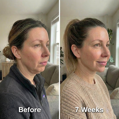 Collagen Face Sculpt Wrap (Buy 1 Get 1 Free)